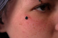 Dermal Piercing