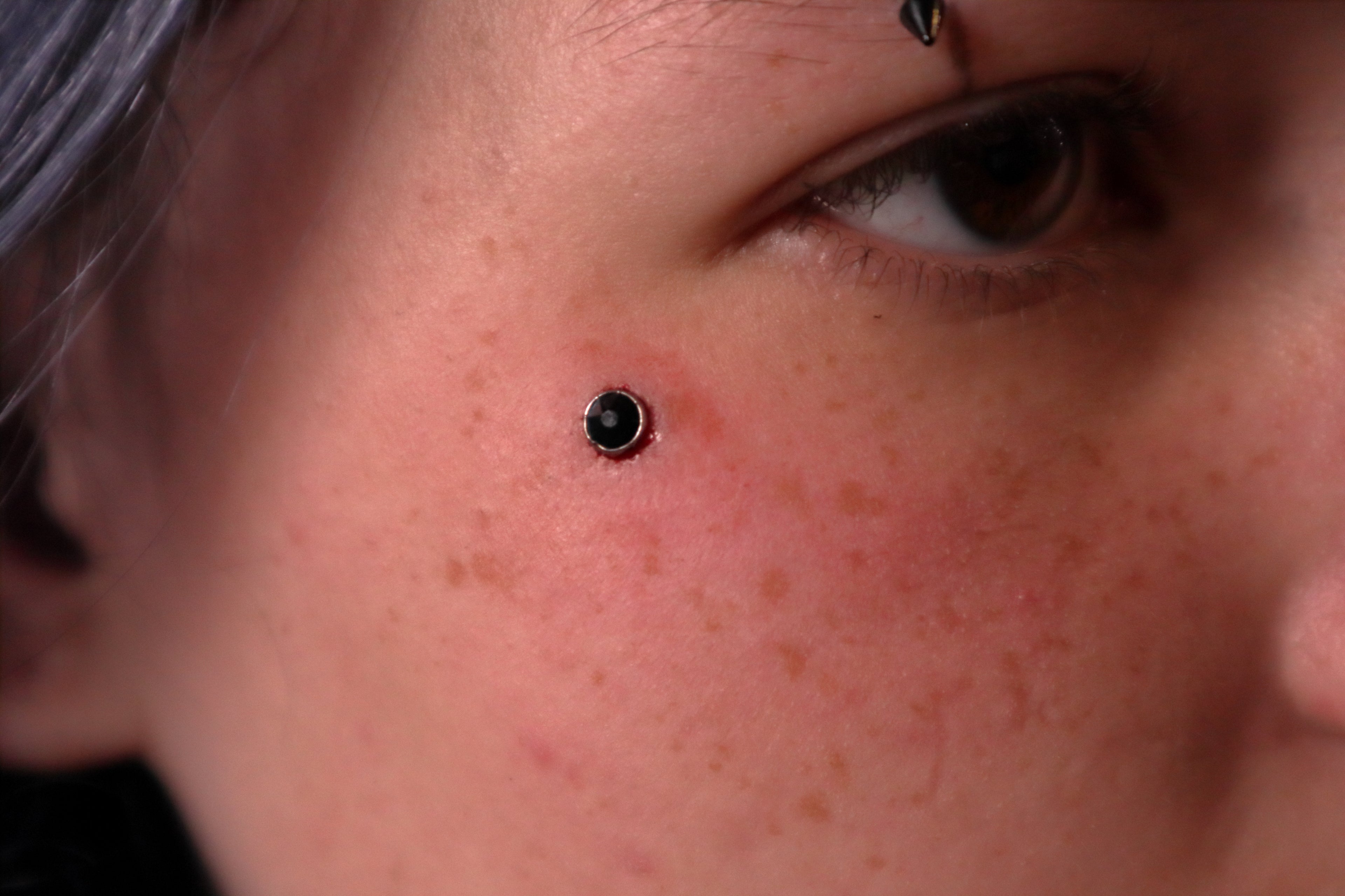 Dermal Piercing